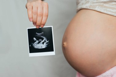 Ultrason resmini hamile bir kız elinde