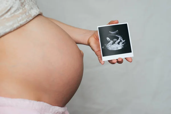 Échographie photo dans les mains d'une fille enceinte sur un fond de ventre — Photo