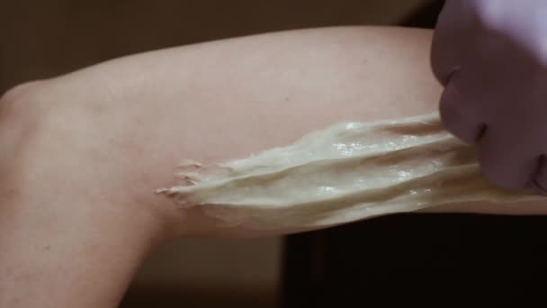 Enthaarung heiße Zuckerpaste Haar auf weibliche Hand in professionellen Schönheitssalon — Stockvideo