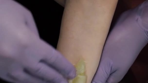 Hair removal on the skin of a womans hand with sugar paste — Stock Video