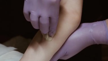 şeker dökülmesi yardımı ile epilasyon modern yöntem