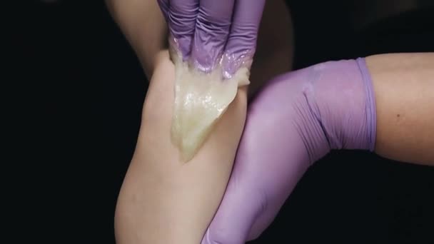 Sugar depilation of hair on the girls hand in a beauty salon — Stock Video