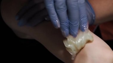 Sıcak balmumuyla şekerleme yaparak saç çıkarma prosedürü