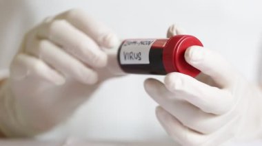 Doctor, laborant indicates ampoule of blood with koronavirus infection, disease