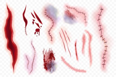 Realistic vector surgical stitches, scars, bruise and slaughter set isolated on the alpha transperant background. Bloody scar. clipart