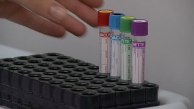 Test tüpleri analiz video için cetrifuge koyarak