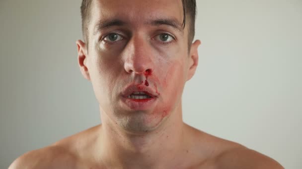 鼻から血を拭く若者の肖像画暴力の概念. — ストック動画