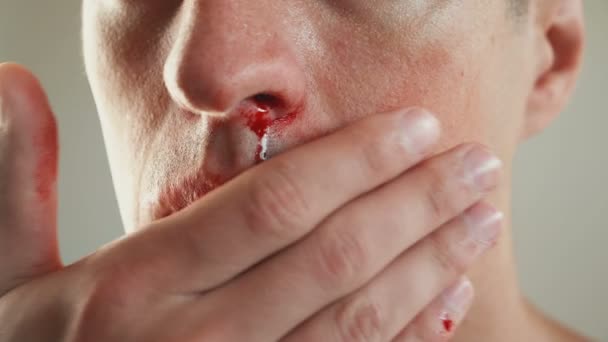 코에서 피를 닦는 젊은이의 클로즈업. 폭력의 개념. — 비디오