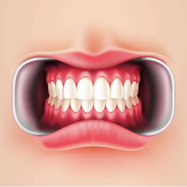 Braces dentaires vectorielles, système de freins oraux 3d — Image vectorielle