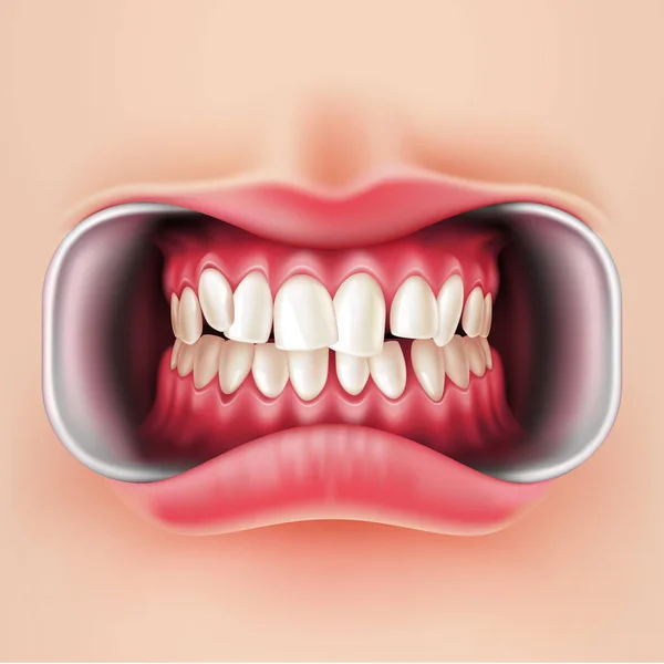 Featured image of post Crooked Teeth Clipart 50 000 vectors stock photos psd files