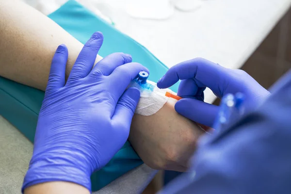 Enfermera Médica Con Guantes Látex Azul Introduce Catéter Vena Del — Foto de Stock