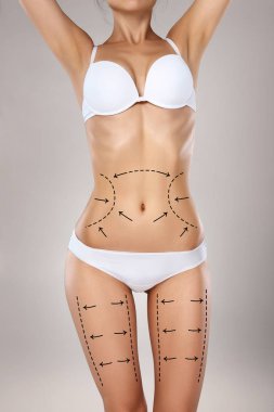 Studio HD capture of a unrecognizable young woman torso in underwear with the drawing arrows and medical marks. Fat lose, liposuction, cellulite removal and skin lifting concept. clipart