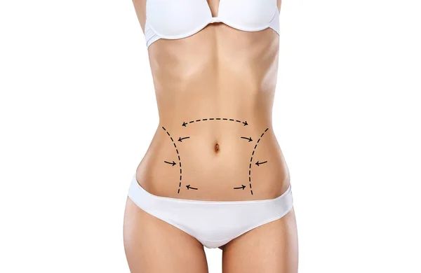 Stüdyo Hd yakalama tanınmaz halde genç kadın gövde çizim oklar ve tıbbi işaretleri ile iç çamaşırı. Yağ kaybetmek, liposuction, selülit Temizleme ve deri kavramı kaldırma.