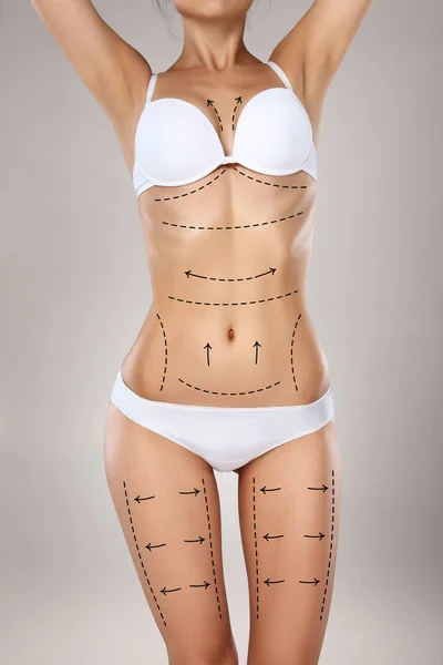 Stüdyo Hd yakalama tanınmaz halde genç kadın gövde çizim oklar ve tıbbi işaretleri ile iç çamaşırı. Yağ kaybetmek, liposuction, selülit Temizleme ve deri kavramı kaldırma.