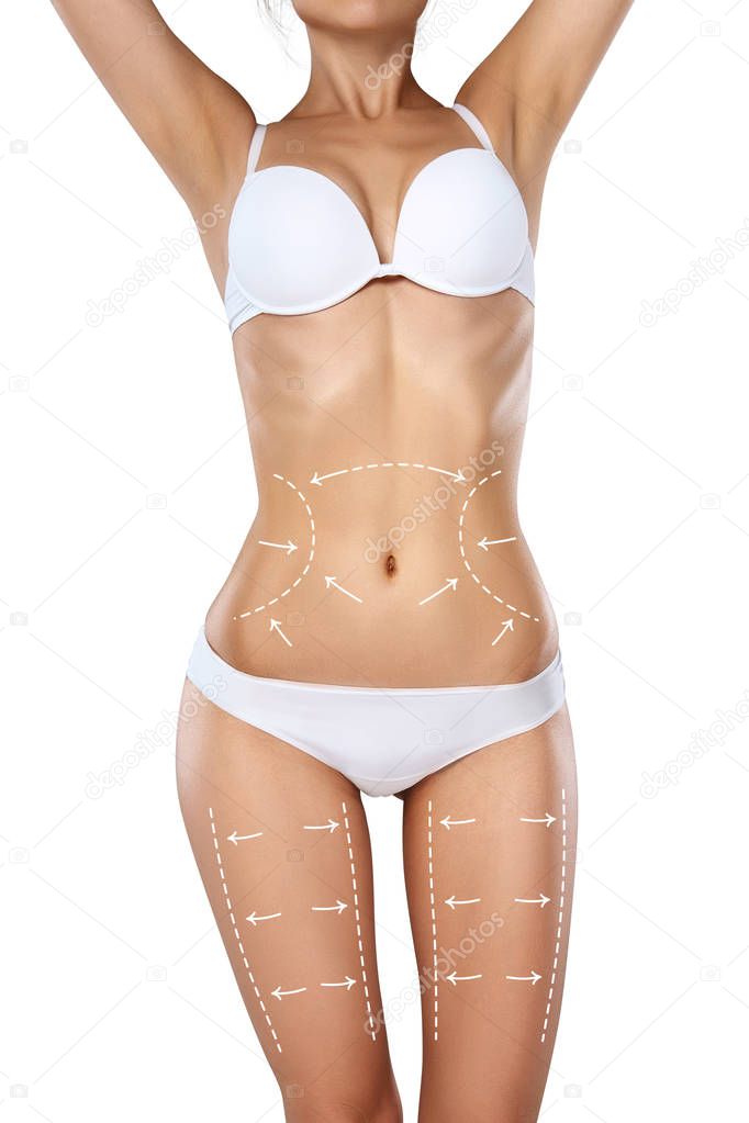 Studio HD capture of a unrecognizable young woman torso in underwear with the drawing arrows and medical marks. Fat lose, liposuction, cellulite removal and skin lifting concept.