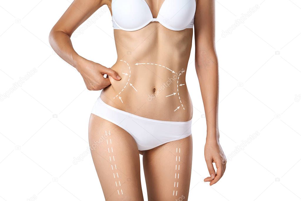 Studio HD capture of a unrecognizable young woman torso in underwear with the drawing arrows and medical marks. Fat lose, liposuction, cellulite removal and skin lifting concept.