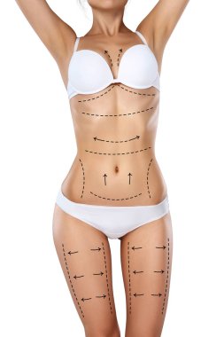 Stüdyo Hd yakalama tanınmaz halde genç kadın gövde çizim oklar ve tıbbi işaretleri ile iç çamaşırı. Yağ kaybetmek, liposuction, selülit Temizleme ve deri kavramı kaldırma.