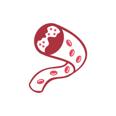 Arter sağlığı nda kolesterol risk vektör tasarımı İllüstrasyon