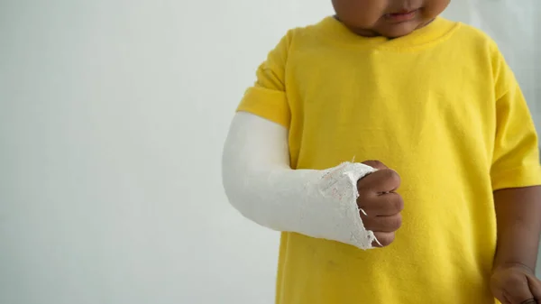 Netter Junge Handknochen Bei Unfall Mit Armschiene Gebrochen — Stockfoto