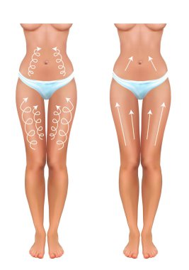 massage lines on the legs in the abdomen and thighs clipart