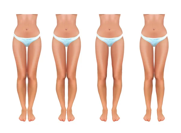 Ortopedi vektör Illustration. varus ve valgus