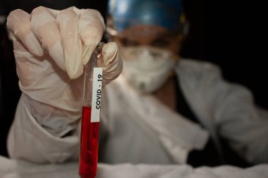 Yeni gerçeklikte Mexico City 'deki test tüpünde bulunan olası tıbbi tedavi veya aşı için Covid-19 plazma deneyi