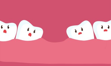 Mahsup diş diş çekimi nedeniyle. İllüstrasyon.