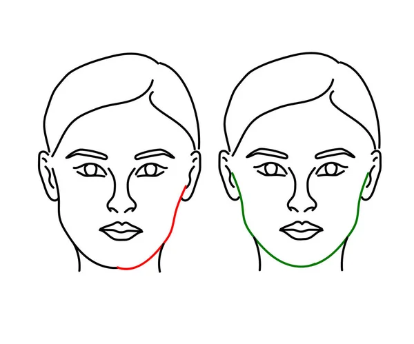 Ženská Tvář Bílém Pozadí Korekce Obličeje Lícních Kostí Vektorová Ilustrace — Stockový vektor