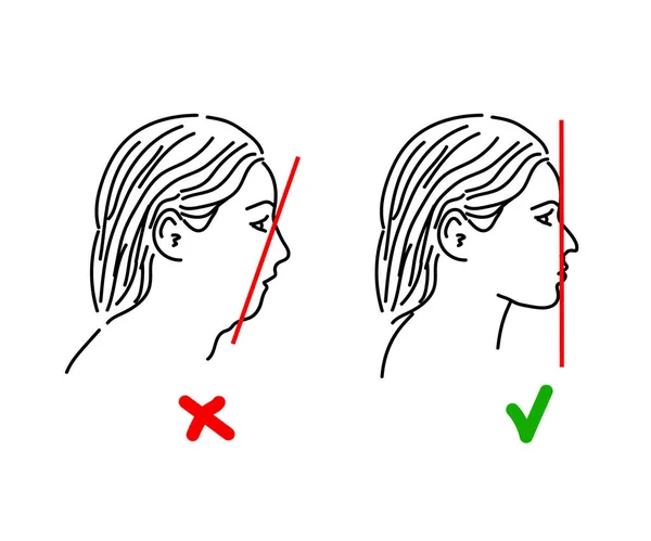 Silueta Una Cabeza Femenina Sobre Fondo Blanco Corrección Facial Postura — Archivo Imágenes Vectoriales