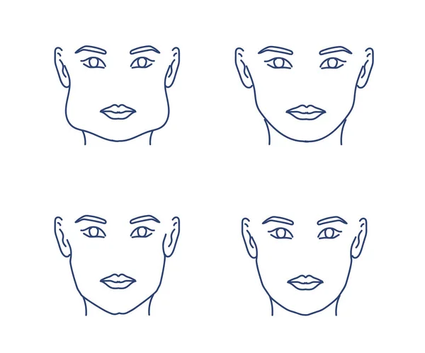 Ženská Tvář Bílém Pozadí Korekce Lícní Kosti Vektorová Ilustrace — Stockový vektor