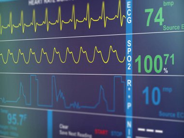 EKG kardiyogram portre
