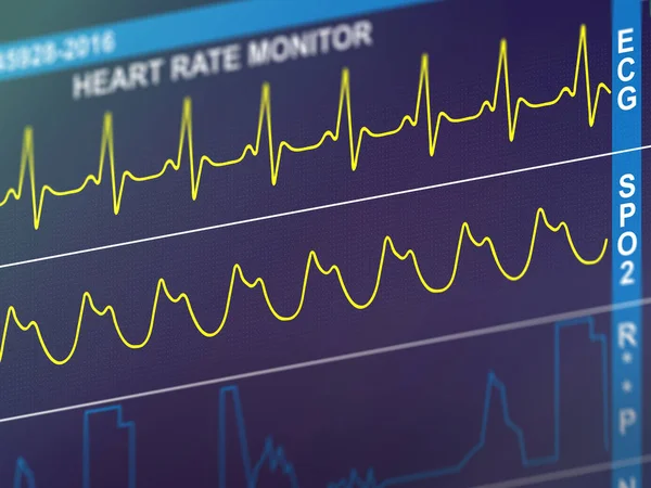 EKG, srdeční frekvence — Stock fotografie