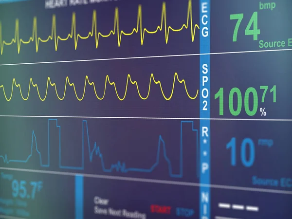 Primer plano del cardiograma del ECG —  Fotos de Stock
