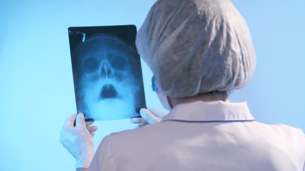 Médico olha para raio-x do crânio — Vídeo de Stock