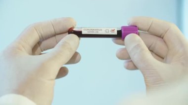 COVID-19 üzerinde bir doktorun ellerinde test edin.