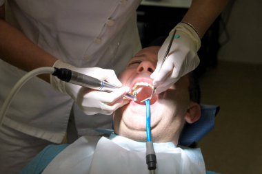 Diş diş parlatma. Diş temizliği, diş temizliği. Dişçi Diş Kliniği ve office iş araçları ayna, yumuşak diş fırça ve emme borusu ağzına hasta diş parlatma.