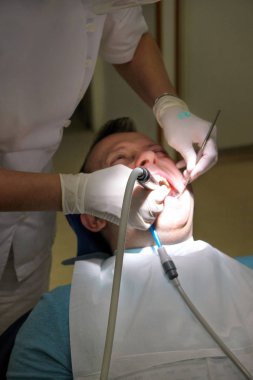 Diş diş parlatma. Diş temizliği, diş temizliği. Dişçi Diş Kliniği ve office iş araçları ayna, yumuşak diş fırça ve emme borusu ağzına hasta diş parlatma.