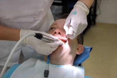 Diş diş parlatma. Diş temizliği, diş temizliği. Dişçi Diş Kliniği ve office iş araçları ayna, yumuşak diş fırça ve emme borusu ağzına hasta diş parlatma.