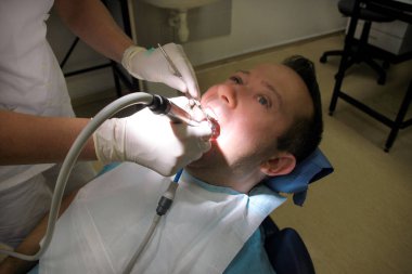 Diş diş parlatma. Diş temizliği, diş temizliği. Dişçi Diş Kliniği ve office iş araçları ayna, yumuşak diş fırça ve emme borusu ağzına hasta diş parlatma.