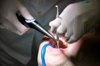 Diş durulama için diş araç. Diş temizliği, diş temizliği. Dişçi Diş Kliniği ve office iş yerinde ayna ile hasta diş temizleme aracı sprey ve emme tüpü ağzına durulama.