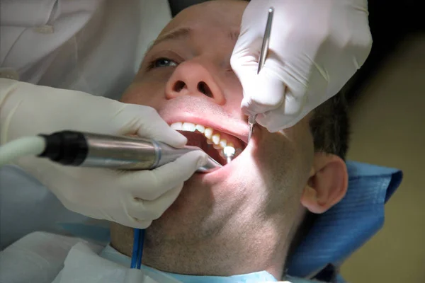 Tandheelkundige Tand Polijsten Gebit Reinigen Mondhygiëne Tandarts Het Werk Zijn — Stockfoto