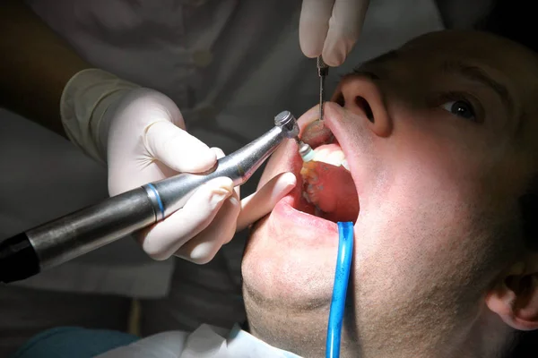 Dental tooth polishing. Teeth cleaning, dental hygiene. Dentist at work in his dentist clinic and office is polishing of patient teeth with tools mirror, soft dental brush and suction tube in mouth.