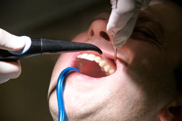 Diş Durulama Için Diş Araç Diş Temizliği Diş Temizliği Dişçi — Stok fotoğraf
