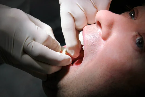 Zubní Souboru Pruh Pro Čištění Dentální Hygiena Zubů Zubař Práci — Stock fotografie