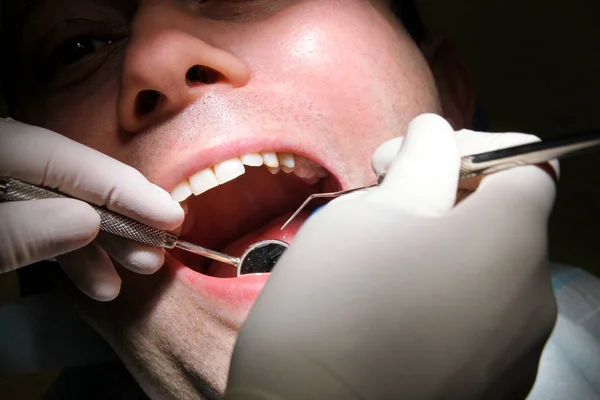 Zubní Prohlídka Zubní Prohlídku Dentální Nástroje Sondou Zrcadlo Sací Trubice — Stock fotografie