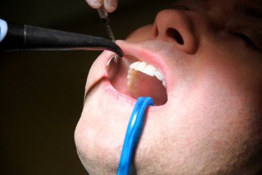 Diş durulama için diş araç. Diş temizliği, diş temizliği. Dişçi Diş Kliniği ve office iş yerinde ayna ile hasta diş temizleme aracı sprey ve emme tüpü ağzına durulama.