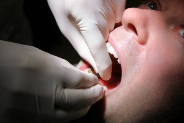 Diş temizliği, diş hijyeni için diş dosya şerit. Diş hekimi diş kliniği ve office iş yerinde olduğunu diş diş dosya şerit elinde olan hasta temizliği. Diş Hekimliği, ağız hijyeni kavramı.