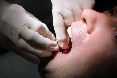 Diş temizliği, diş hijyeni için diş dosya şerit. Diş hekimi diş kliniği ve office iş yerinde olduğunu diş diş dosya şerit elinde olan hasta temizliği. Diş Hekimliği, ağız hijyeni kavramı.