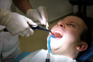 Diş durulama için diş araç. Diş temizliği, diş temizliği. Dişçi Diş Kliniği ve office iş yerinde ayna ile hasta diş temizleme aracı sprey ve emme tüpü ağzına durulama.