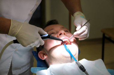 Diş durulama için diş araç. Diş temizliği, diş temizliği. Dişçi Diş Kliniği ve office iş yerinde ayna ile hasta diş temizleme aracı sprey ve emme tüpü ağzına durulama.